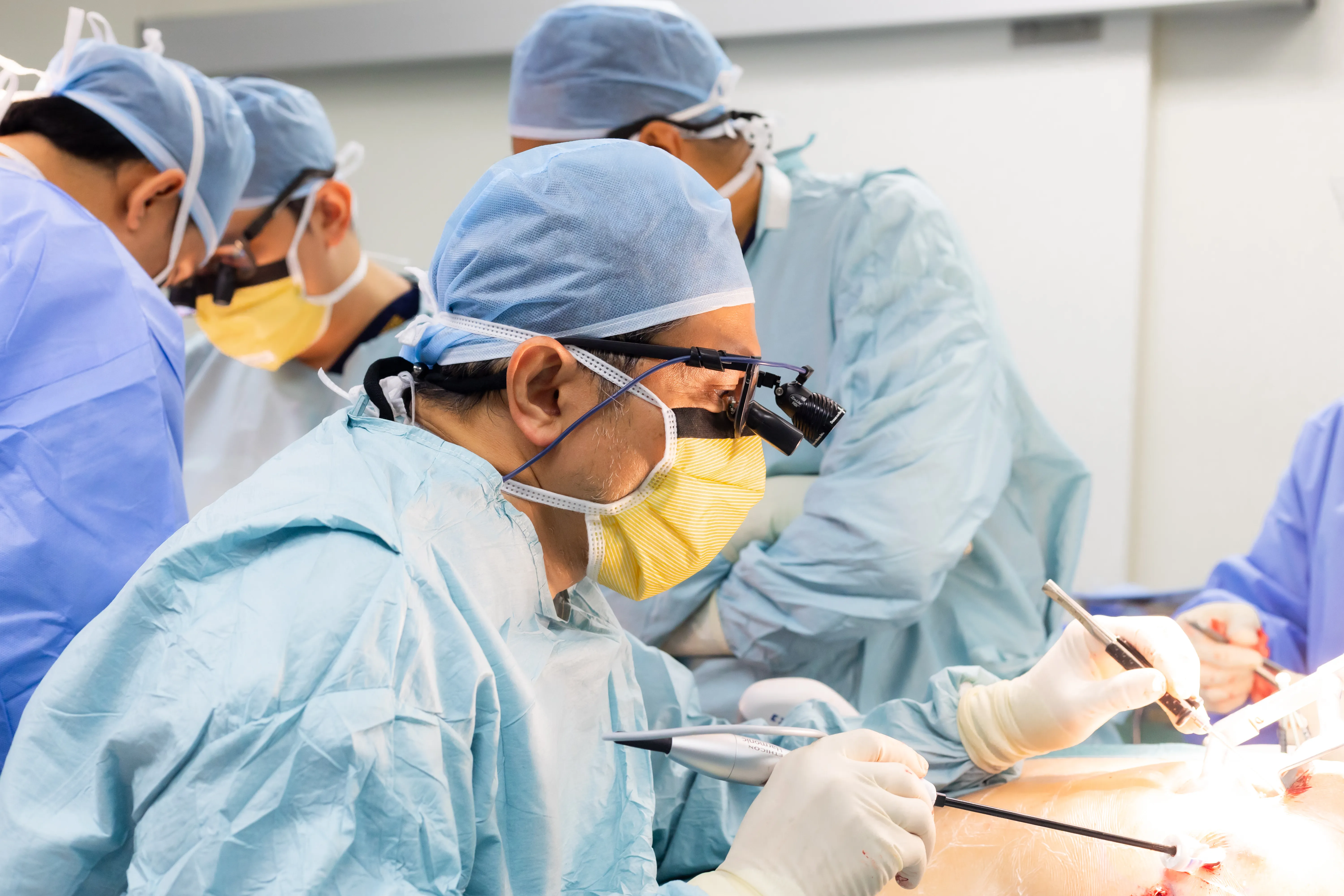 Prof. Dr. Shahrul Amry Hashim performing minimally invasive cardiac surgery with his surgical team at KPJ Damansara Specialist Hospital 2, wearing surgical loupes